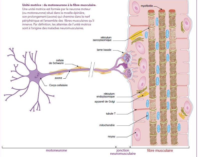 Qu’appelle t'on maladie neuromusculaire ? Groupe d'intérêt MNMND de l